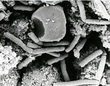 Imagen a microscopía electrónica de la bacteria del Antrax: This image is a work of a U.S. military
or Department of Defense employee, taken or made as part of that person's official duties. As a
work of the U.S. federal government, the image is in the public domain.